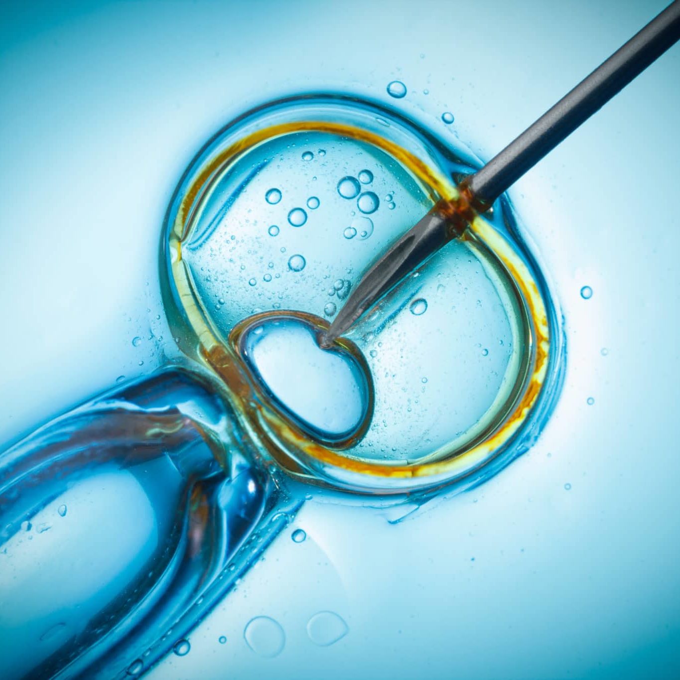 In Vitro Fertilisation, IVF Macro Concept IVF
